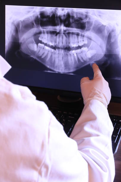 Best Emergency Root Canal Therapy in North Fort Myers, FL